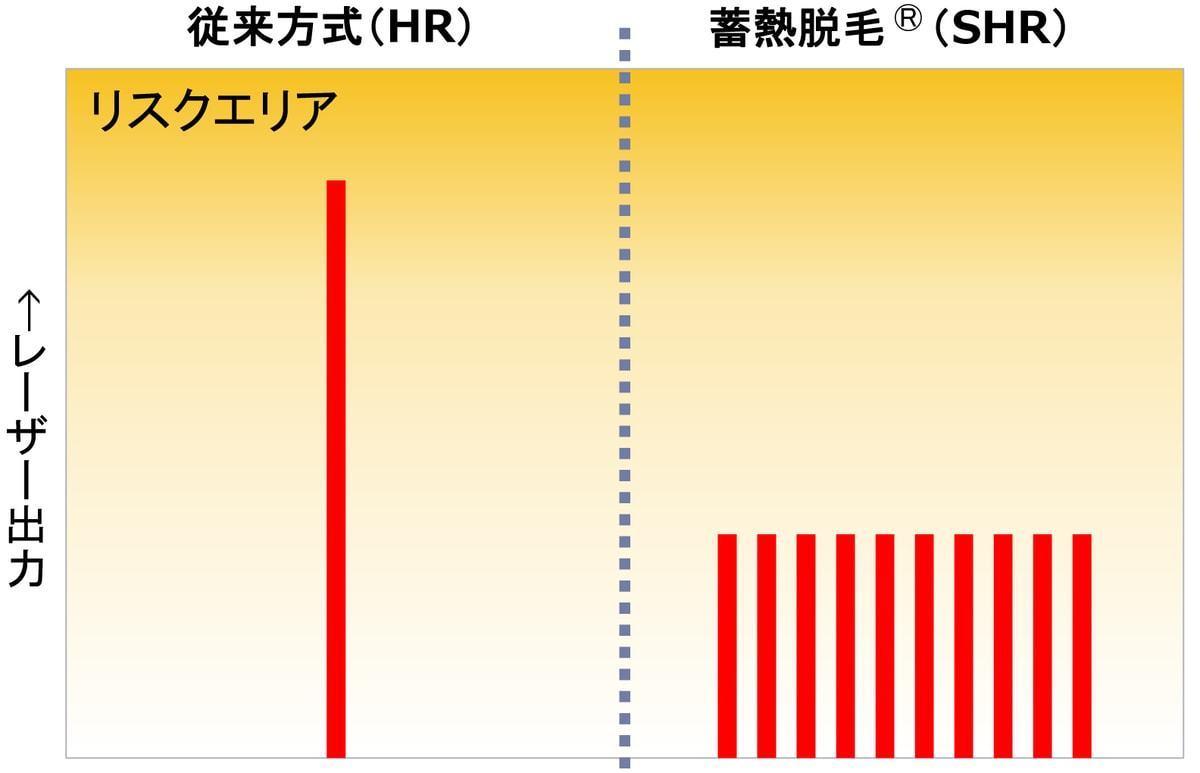 レーザー出力