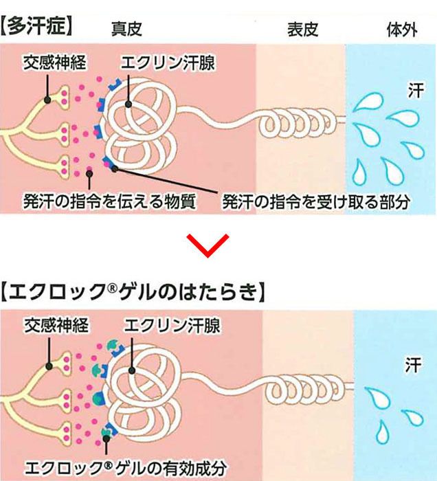 保険適応の新しい制汗剤