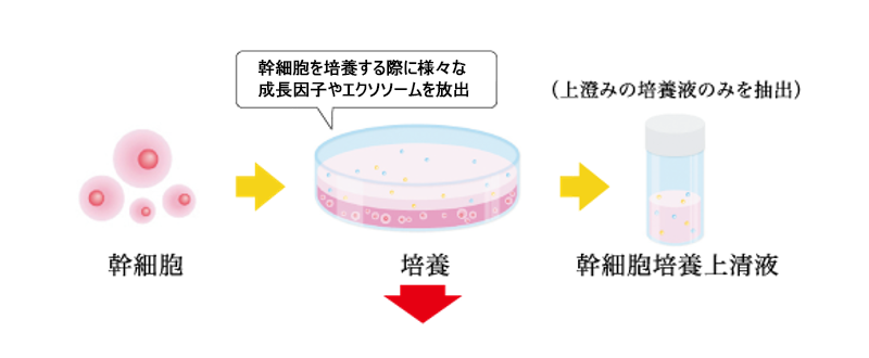 エクソソーム(浄化濃縮幹細胞上清液)