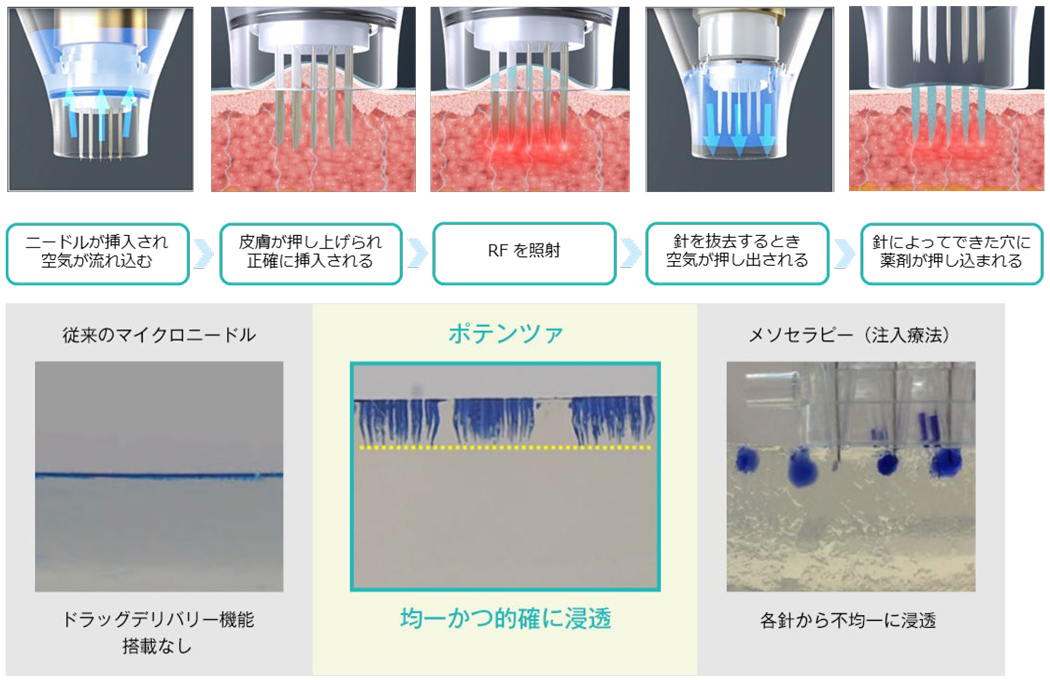 CP チップ　ドラッグデリバリー