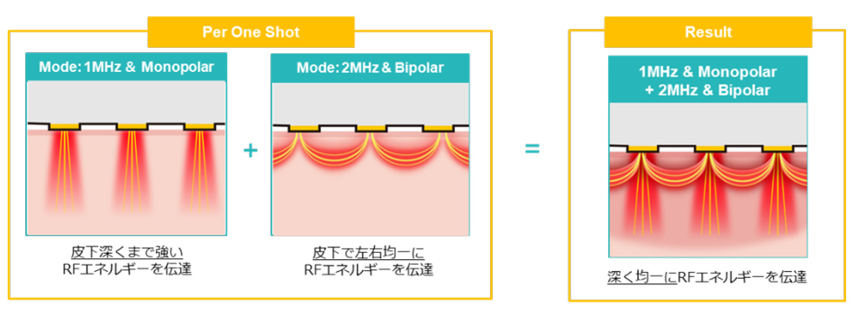 DIAMOND チップ