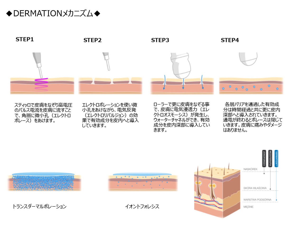 DERMATIONメカニズム