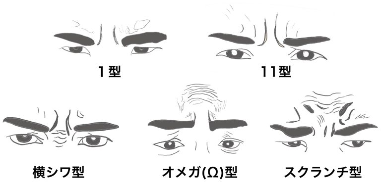 眉間のしわ